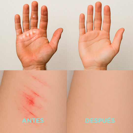 ILHŨ - Skin Repair