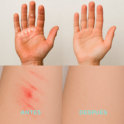ILHŨ - Skin Repair